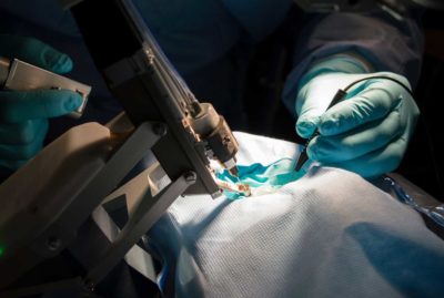 Instructions for Patients who have had VITREO-RETINA surgery