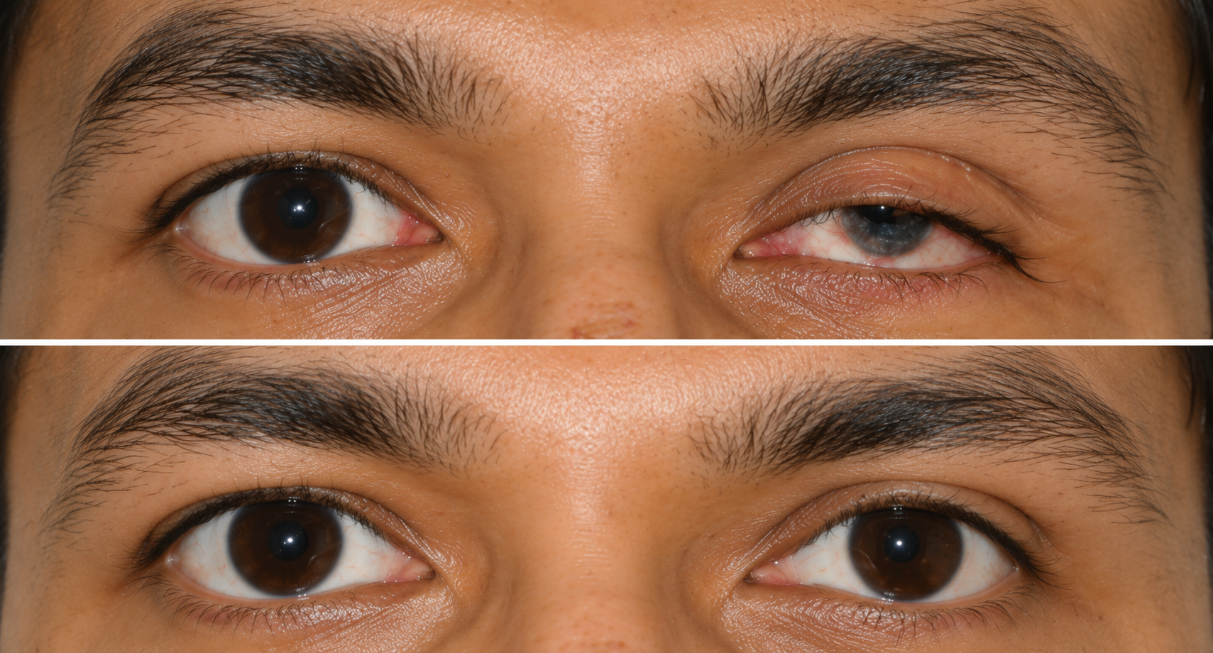 Vitreo Retina Clinic